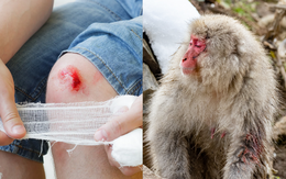 Tại sao vết thương của con người lại lâu lành hơn động vật?