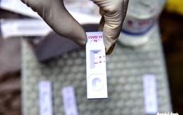 Có triệu chứng nghi ngờ mắc COVID-19, cần test nhanh không?