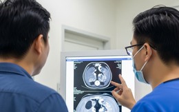 Những nguy cơ và lời khuyên quan trọng khi cần chụp CT