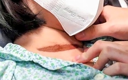 Thêm một bé gái bị cửa cuốn tự động kẹp cổ, ngưng tim