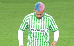 Sao Real Betis nhuộm tóc độc lạ lấy hên nhưng cái kết lại… đắng