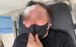 Tài xế bán tải đánh dùi cui vào đầu người đang dừng xe nghe điện thoại