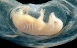 Lần đầu nuôi thành công tim chứa tế bào người trong phôi heo