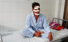 Máy bay nông nghiệp chém trúng đầu người chạy xe máy