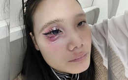 Ảnh vui 20-6: Mới học vẽ cái bọng mắt mà đọc bình luận muốn xỉu