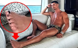 Vì sao Ronaldo sơn móng chân màu đen?