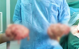 Nữ bệnh nhân mắc bệnh hiếm, hai vùng đùi bên ngoài như hai quả bóng