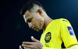 Cầu thủ Malaysia bị tạt axit sắp đấu với tuyển Việt Nam