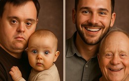 Sự thật về hình ảnh cảm động của người cha mắc hội chứng Down và con trai