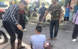 Một TikToker bị chém gần đứt lìa bàn tay