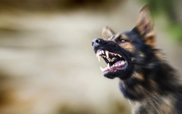 Bé 5 tuổi bị chó cắn hàng chục vết thương sâu ở mặt, phải khâu 20 mũi