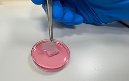 Đột phá da nhân tạo sinh học giúp trị bỏng nhanh, an toàn