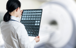 Não người có bị 'hết dung lượng' ghi nhớ không?