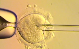 Đột phá IVF ở Anh: Mẹ có đột biến trong ti thể, 8 em bé vẫn chào đời khỏe mạnh