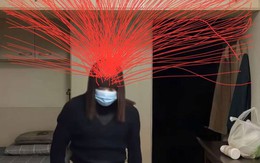 'Sợi chỉ đỏ mọc trên đầu' tràn ngập cõi mạng có ý nghĩa gì?