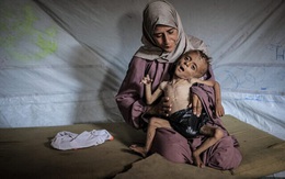 Bức ảnh cậu bé gầy trơ xương vì đói ở Gaza bị tố là ảnh giả