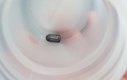 Đã tìm ra người bắn súng hơi khiến đạn lạc trúng đầu người phụ nữ làm vườn