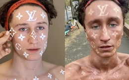 Thanh niên 'xăm' họa tiết Louis Vuitton bằng… nắng trời