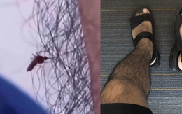 Ảnh vui 13-8: Một ông cháu chia sẻ về bộ giáp gai chống muỗi của mình