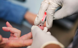 Xét nghiệm mới phát hiện bệnh nguy hiểm qua 1 giọt máu, giá chỉ 50.000 đồng