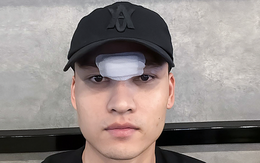 Bị sút thẳng mặt, Bùi Hoàng Việt Anh phải khâu 14 mũi