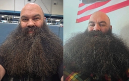Người có bộ râu đẹp nhất thế giới suýt chết nghẹn vì bộ râu của chính mình