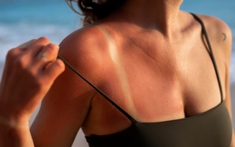 Đừng tin lời đồn ánh nắng mặt trời không gây ung thư da