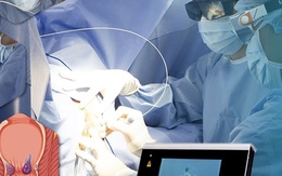 'Ôm' điện thoại quá lâu khi đi vệ sinh làm tăng nguy cơ bệnh trĩ