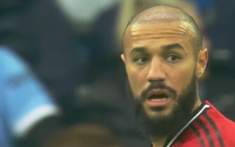 Fan rần rần phát hiện sao Man Utd cấy tóc