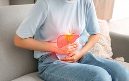 Người bệnh gan đối mặt rủi ro biến chứng khi mắc sốt xuất huyết Dengue