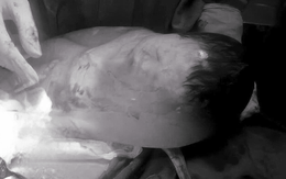 Hiếm gặp: Bé trai chào đời còn nguyên bọc ối