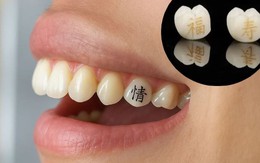 Xăm răng - xu hướng làm đẹp đang rộ lên tại một đất nước