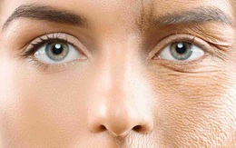 Serum tự làm từ phèn chua và vitamin E giúp xóa nếp nhăn vĩnh viễn?