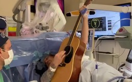 Vừa được mổ não vừa chơi guitar, sao hay thế?