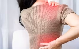 Những ngộ nhận phổ biến về thuốc giảm cholesterol