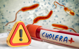 Dịch tả diễn biến phức tạp ở nhiều quốc gia, Bộ Y tế cảnh báo nguy cơ