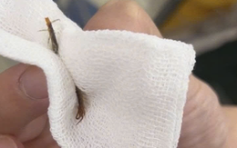 Rết dài 5cm chui vào tai khi đang ngủ