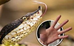 Nuôi rắn độc làm thú cưng, người đàn ông bị cắn mất ngón tay
