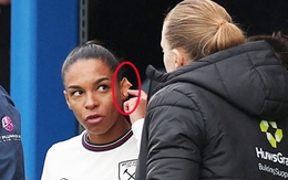 Nữ tuyển thủ Pháp không thể ra mắt CLB West Ham chỉ vì chiếc khuyên tai