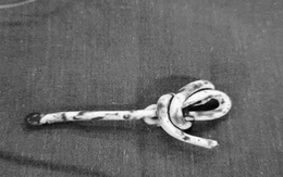 Bé trai cấp cứu do nhét dây vào lỗ tiểu, theo clip 'thử thách' trên mạng