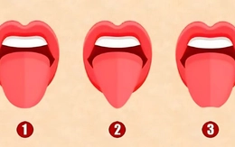 Quiz: Bạn độc đáo, thông minh hay người vui vẻ, dễ gần