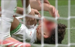 Ngôi sao Morocco dính chấn thương kinh hoàng ở trận chung kết AFCON