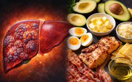 Ăn nhiều chất béo, giảm tinh bột có 'nuôi' ung thư gan?