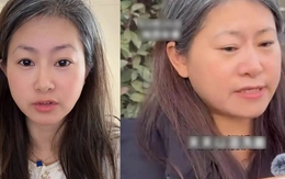 Bạc cả tóc chỉ sau một đêm khi biết chồng ngoại tình