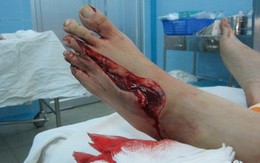 Bảo vệ bàn chân khi tham gia giao thông