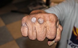 C&acirc;u chuyện cuộc đời của những người cao tuổi