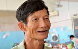 Nhổ hết hàm răng  dù không đau răng