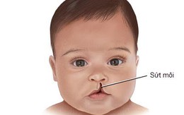 Mổ từ thiện cho trẻ em